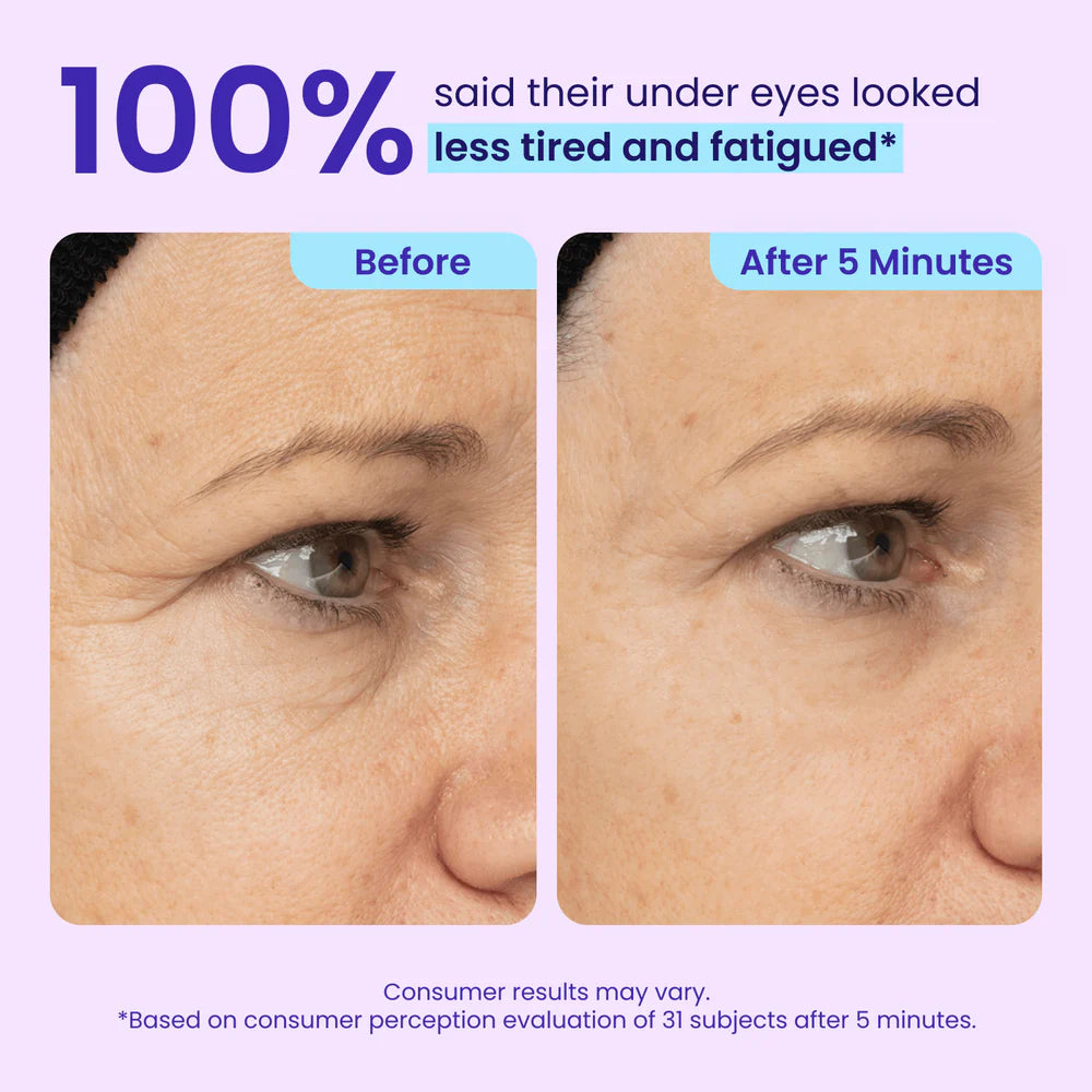 GOPURE Korean Instant Lifting Eye Gel | Brightening & Anti-Aging Care