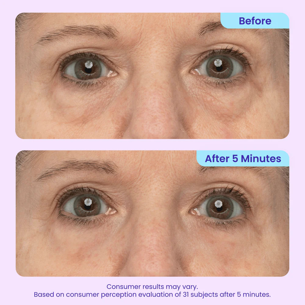 GOPURE Korean Instant Lifting Eye Gel | Brightening & Anti-Aging Care